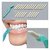 Premium Quality DENTAL WHITENING STICK + 25 Whitening Erasers - Teeth Care Kit