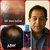 On On Maha Bhringraj Herbal Hair Oil Combo Pack of 5
