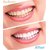 Luma Smile Tooth Polisher Whitener Stain Remover with LED Light