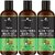 Park Daniel Premium  Onion Aloe Vera Hair Oil Enriched With Vitamin E- For Conditioning and Smooth Hair Combo Pack 3 Bottle of 100 ml(300 ml)