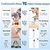 derma solution Plastic Blackhead Remover Vacuum Suction Device