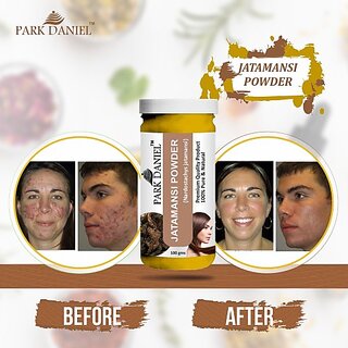 PARK DANIEL Premium Jatamansi Powder - Promote Hair Growth & Helps to Blacken the Hair (100 gms) (100 g)