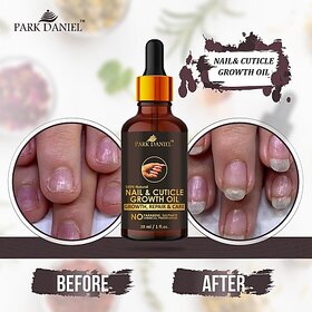 PARK DANIEL Premium Nail & Cuticle Growth Oil- For Nail Growth, Repair & Cuticle Care(30 ml) Yellow ()