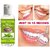 Teeth Whitening Gel Just In 10 Second With Mint Flavour Teeth Whitening Liquid  (50 ml)