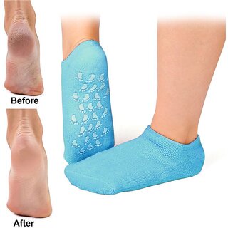 2 Pieces Ankle Brace Support  Free Size