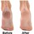 2 Pieces Ankle Brace Support  Free Size