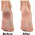 2 Pieces Ankle Brace Support  Free Size
