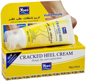 Yoko Cracked Heel Cream (50g)