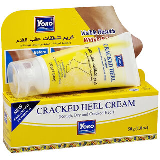 Yoko Cracked Heel Cream (50g)