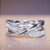 Magnetic Slimming Ring Weight Loss, Fashion Weight Loss Ring, Magnetic Health Fitness Jewelry Weight Loss Fat Burning Lazy Slimming Therapy