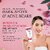 Globus Naturals Glycolic  1 Salicylic Acid Anti Acne Peel Off Mask For Oily  Acne Prone Skin Natural  Ayurvedic Formula Chemical Free Cruelty Free 100 gms Set of 2