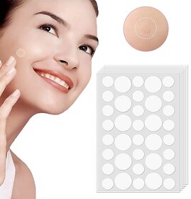Acne Pimple Patches For Face, Hydrocolloid Dressing Cover, Dots for Spots Pimple Patches, Effectively Calms  Relieves