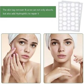 Acne Pimple Patch-Invisible Facial Stickers cover with 100 Hydrocolloid(18Dots)