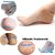 Eastern Club Heel Socks for Cracked Feet Heel Protector for Women Heel Anti Crack Set for Women 1 Pair.