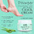 Globus Naturals Crack Cream Green 50 gm, Srt of 3