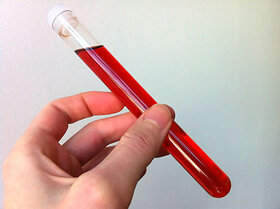 Ankol Oil for All types of Magical Or Pooja Ritual 10ml Very Rare Top Secret