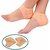 Silicone Gel Unisex Heel Pad Socks For Cracked Heels and Swelling Pain Relief (Free Size) (1 Pair)
